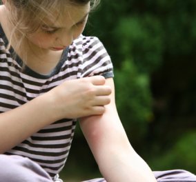 Να οι λόγοι που μας τσιμπάνε τα κουνούπια: Όχι απλά γιατί είμαστε "γλυκοαίματοι" 