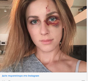 Ο γιος του βασιλιά των σούπερ μάρκετ στη Βραζιλίας χτύπησε άγρια το κορίτσι του - Εκείνη διάσημη σταρ του Instagram έκανε αναρτήσεις