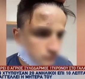 Σοκάρει ο άγριος ξυλοδαρμός 17χρονου στο Γαλάτσι - Καταγγέλει ότι τον χτύπησαν 20 ανήλικοι (βίντεο)