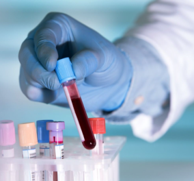 Νέα εξέταση αίματος θα μπορούσε να σταματήσει έναν στους 10 θανάτους από καρκίνο – Το «Holy Grail» εντοπίζει πάνω από 50 τύπους όγκων πριν τα συμπτώματα 
