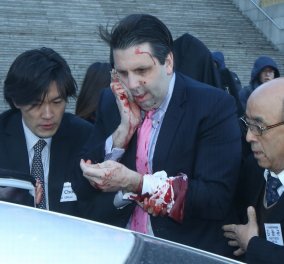 Επίθεση - σοκ με μαχαίρι στον πρέσβη των ΗΠΑ στη Νότια Κορέα - Χρειάστηκε 80 ράμματα στο πρόσωπο! (φωτό)