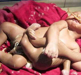 Ινδία: Μωρό με... 8 πόδια, θεωρείται μετενσάρκωση θεού επί της Γης - Το ονόμασαν «Αγόρι Θεό» και μιλούν για θαύμα! - Κυρίως Φωτογραφία - Gallery - Video