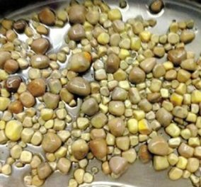 Απίθανο story: Γιατροί αφαίρεσαν 420 πέτρες από τα νεφρά Κινέζου λόγω... υπερβολικής κατανάλωσης τόφου