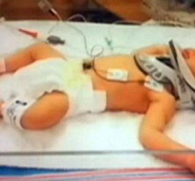 Απίστευτο περιστατικό στο Πίτσμπεργκ των ΗΠΑ: Νοσοκόμα αποκοιμήθηκε & το νεογέννητο της έπεσε από τα χέρια