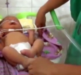 Βίντεο: Μωρό -αγγελούδι ο Angelito γεννήθηκε με δύο «σωληνάκια» αντί για μύτη  - Κυρίως Φωτογραφία - Gallery - Video
