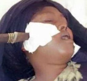 Κένυα: Αποτροπιασμό προκαλούν οι εικόνες με το μαχαίρωμα στο πρόσωπο μιας γυναίκας από τον άντρα της (φωτό) 