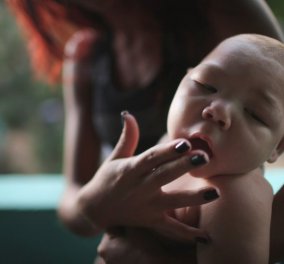 Παγκόσμια Οργάνωση Υγείας: Τεράστια απειλή ο ιός Ζίκα σε όλο τον πλανήτη - Κυρίως Φωτογραφία - Gallery - Video