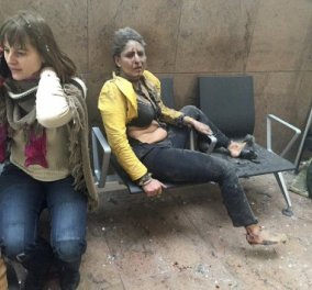 Σε τεχνητό κώμα η γυναίκα - σύμβολο των επιθέσεων στις Βρυξέλλες - Κυρίως Φωτογραφία - Gallery - Video