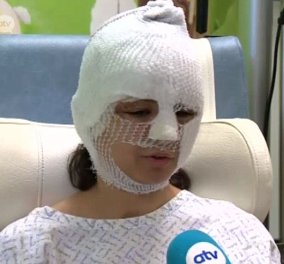 20χρονη τραυματίας των Βρυξελλών με εγκαύματα: Ήρθε το τέλος του κόσμου είπα…  - Κυρίως Φωτογραφία - Gallery - Video