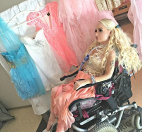 H συγκινητική ιστορία της 26χρονης τετραπληγικής Τζάσμιν: Ξόδεψε πάνω από 12.000 ευρώ για να γίνει σαν τη Barbie  - Κυρίως Φωτογραφία - Gallery - Video