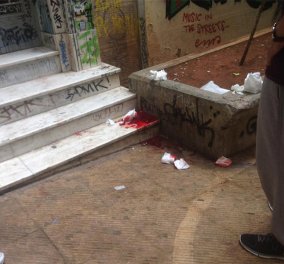 Τρόμος στα Εξάρχεια:  35χρονος έπεσε νεκρός από σφαίρες 2 κουκουλοφόρων - Όλες οι φώτο  - Κυρίως Φωτογραφία - Gallery - Video