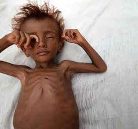 Γι'αυτά τα παιδιά που πεθαίνουν από την πείνα στην Υεμένη (φωτό) υπάρχει έλεος ; - Κυρίως Φωτογραφία - Gallery - Video