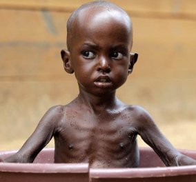 Δραματικές ώρες για την Σομαλία: 110 νεκροί σε 2 μέρες από την πείνα - 1,4 εκ παιδιά αντιμέτωπα με τον θάνατο - Κυρίως Φωτογραφία - Gallery - Video
