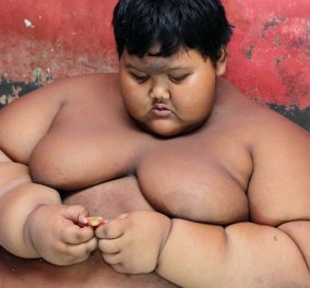 Story of the day: 11χρονο αγόρι ζυγίζει 192 κιλά- Δεν μπορεί να αναπνεύσει ούτε να κοιμηθεί (Φωτό - Βίντεο) - Κυρίως Φωτογραφία - Gallery - Video