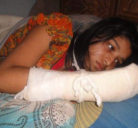 Μουσουλμάνος έκοψε τα 5 δάχτυλα της 21χρονης συζύγου του & την φίμωσε: Ήθελε να σπουδάσει 