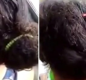Αηδιαστικό αλλά έχει πλάκα: Επιβάτης λεωφορείου βιντεοσκοπεί τα γεμάτα ψείρες άλουστα μαλλιά μιας γυναίκας  