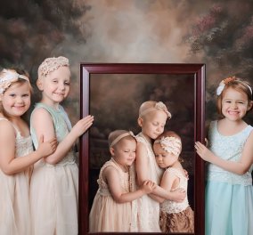 Story of the day: 3 μικρές - μεγάλες νικήτριες της ζωής - βγήκαν από καρκίνο και φωτογραφίζονται χωρίς & με τα μαλλάκια τους