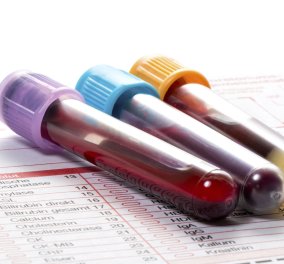 Ελπιδοφόρα ανακάλυψη: Ένα τεστ αίματος αρκεί για να ανιχνεύσει τον καρκίνο μέσα σε 10 λεπτά!