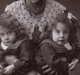 40 vintage φωτογραφίες από τα δυστυχισμένα δίδυμα Daisy & Violet Hilton - Κυρίως Φωτογραφία - Gallery - Video
