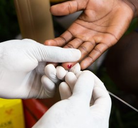 Γιατρός μόλυνε 90 άτομα με τον ιό του AIDS - Χρησιμοποίησε σε όλους κοινή σύριγγα - Κυρίως Φωτογραφία - Gallery - Video