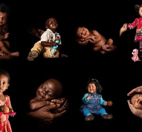 Οι μικροί - μεγάλοι νικητές της ζωής: 14 πανέμορφα πρόωρα μωράκια τότε & τώρα (φώτο) - Κυρίως Φωτογραφία - Gallery - Video
