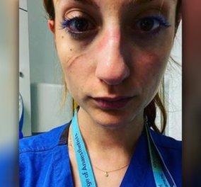 Η Ελληνίδα γιατρός Βάσια Πάσχου στην Οξφόρδη: Αυτό είναι το πονεμένο & κουρασμένο πρόσωπό μου - Δουλεύουμε 12ωρα