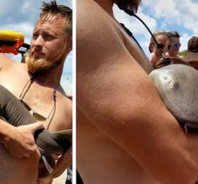 Καρχαρίας δάγκωσε άντρα μέσα στη θάλασσα: Εκείνος βγήκε τραβώντας τον σαν μωρο στη στεριά - Περίμενε 45 λεπτά να τον σώσουν (βίντεο)