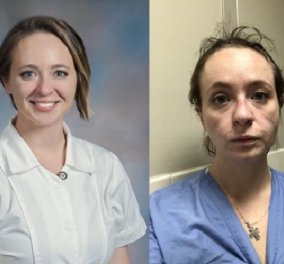 Πριν & μετά: Συγκινεί η εικόνα μιας 27χρονης νοσοκόμας έπειτα από 8 μήνες στη "μάχη" με τον κορωνοϊό- Κουρασμένη, γερασμένη, ταλαιπωρημένη (φωτό- βίντεο) - Κυρίως Φωτογραφία - Gallery - Video