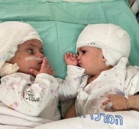 Ισραήλ: Σιαμαία κοριτσάκια κοιτάζονται για πρώτη φορά μετά από επέμβαση «ζωής ή θανάτου» - ήταν ενωμένα τα κεφαλάκια τους (βίντεο) - Κυρίως Φωτογραφία - Gallery - Video