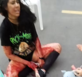 Τρομακτικό βίντεο: 25χρονη δέχεται επίθεση από το σκυλί της μέσα στο ασανσέρ - Η σωτήρια κίνησή της (βίντεο)