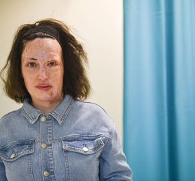 Ιωάννα Παλιοσπύρου: Οι νέες φωτογραφίες χωρίς τη μάσκα - «συνεχίζει να ζει, να ονειρεύεται και να ελπίζει» - Κυρίως Φωτογραφία - Gallery - Video