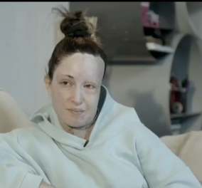 Ιωάννα Παλιοσπύρου: Έβγαλε την μάσκα και συγκλόνισε - ''Αυτό είναι το σημείο 0, η ζωή μου υπάρχει πριν & μετά την επίθεση'' (βίντεο)  - Κυρίως Φωτογραφία - Gallery - Video