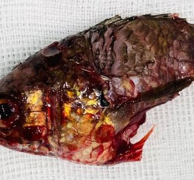 Ταϊλανδός ψαράς μπήκε εσπευσμένα στο νοσοκομείο - Αγκαθωτό ψάρι πήδηξε από το νερό, σφηνώθηκε στον λαιμό του & κόντεψε να τον πνίξει 