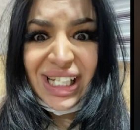 26χρονη πήγε να φτιάξει τα δόντια της & κατέληξε να μοιάζει με άλογο! Ο οδοντίατρος αποδείχτηκε… φοιτητής (βίντεο) - Κυρίως Φωτογραφία - Gallery - Video