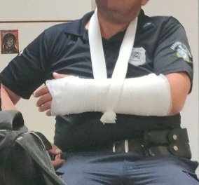 Άγριο περιστατικό στην Λάρισα τα ξημερώματα: Σοκαριστικές οι φωτό με τους τραυματισμένους αστυνομικούς από επίθεση 30 ατόμων