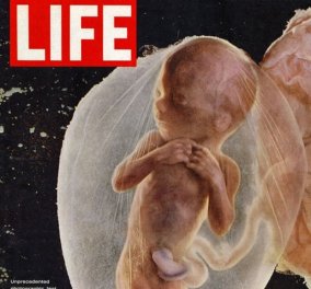 Vintage pic: Αυτή είναι η πρώτη πολυβραβευμένη φωτογραφία εμβρύων που κυκλοφόρησε ποτέ – Life 1965 - Κυρίως Φωτογραφία - Gallery - Video