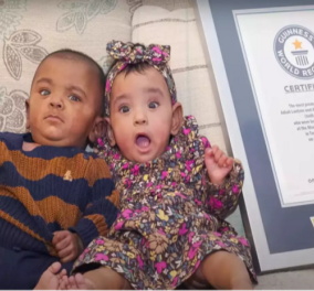 Τα πιο πρόωρα δίδυμα στον κόσμο: Γεννήθηκαν 330γρ. το κοριτσάκι, 420 ο αδελφός της – Μόλις 22 εβδομάδων, σήμερα 1 έτους