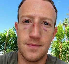 O Mark Zuckerberg ποζάρει με δύο μαυρισμένα μάτια - Με ποιον πιάστηκε στα χέρια; (φωτό) - Κυρίως Φωτογραφία - Gallery - Video