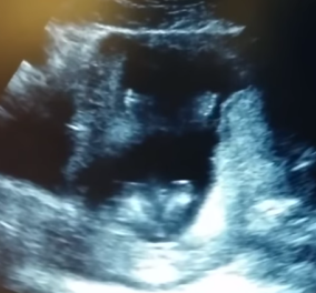 To βίντεο της ημέρας: Έμβρυο χτυπά παλαμάκια όταν τραγουδούν οι γονείς του! - Κυρίως Φωτογραφία - Gallery - Video