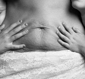 Δεν είμαστε πάντα άψογες μετά τη γέννα: Ρεαλιστικές εικόνες για τη ''μεταμόρφωση'' της κοιλιάς μιας γυναίκας μετά τον τοκετό! (Slideshow) - Κυρίως Φωτογραφία - Gallery - Video