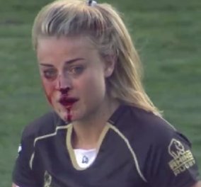 Απίστευτο βίντεο: Παίκτρια ράγκπι αιμορραγούσε και συνέχιζε να παίζει 